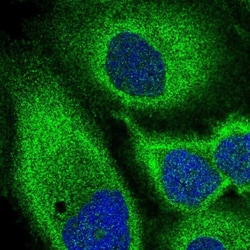 MST3 Antibody, Novus Biologicals:Antibodies:Primary Antibodies